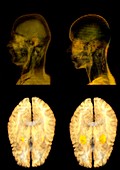 Jealousy research,MRI brain scans
