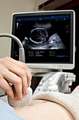 Ultrasound in pregnancy