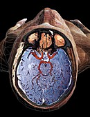 Brain blood supply,MRI scan