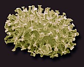 Gastrotrich egg,SEM