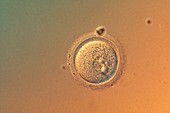 Fertilised human egg,light micrograph