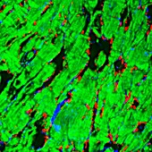 Heart muscle after coronary bypass