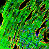 Heart muscle,fluorescence micrograph
