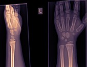 wrist and hand x-ray