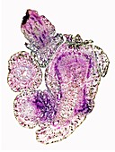 Parasitic vine stem,light micrograph