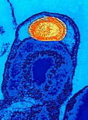 TEM of the bacteria,Coxiella burnetii