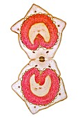Alexander fruit,light micrograph