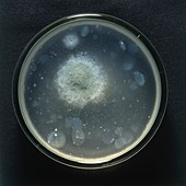 Yeast culture in petri dish,above view