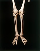 Human skeleton,legs and feet,front view