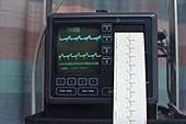ECG monitor with printout coming out