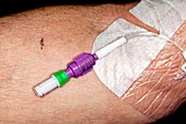 PICC intravenous device