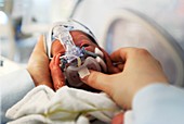 Premature baby using a respirator