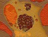 Chlamydia bacteria in a lung cell,TEM