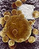 Lymphocyte attacking cancer cell,SEM