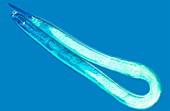 Globodera nematode,light micrograph