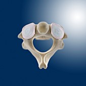 Axis vertebra (C2),artwork