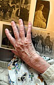 Alzheimer's patient,memory therapy
