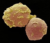 Human monocytes,SEM