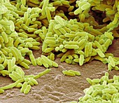Aquaspirillum bacteria,SEM