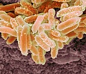 Erwinia bacteria,SEM