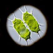 Xanthidium antilopaeum green alga,LM