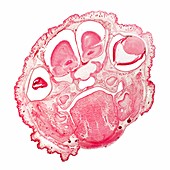 Foetal rat head,light micrograph