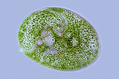 Stentor sp. protozoan,light micrograph