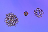 Golden-brown algae and dinoflagellate