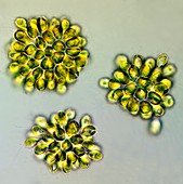 Synura golden algae,light micrograph