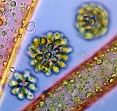 Synura golden algae,light micrograph