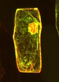 Genetically modified soybean cell