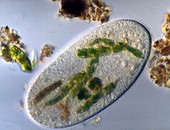Ciliate with ingested prey,LM