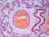 Neonatal lung,light micrograph