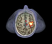 Healthy brain,fMRI scan