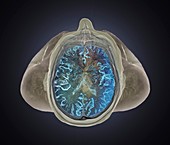 Healthy brain,3D MRI scan