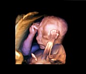 Foetus,3D ultrasound scan