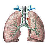 Lymphoid system of the lungs,artwork