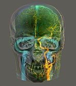 Blood supply of the head,3D CT angiogram