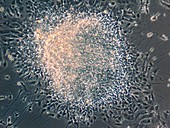 Urine-derived stem cells,LM