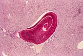 Schistosome parasite,light micrograph