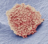 Mesenchymal stem cell,SEM