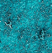 Bacteria on stainless steel,SEM