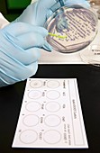 E. coli STEC bacterial test