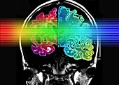 Alzheimer's brain,computer artwork