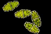Euastrum sp. green alga,LM