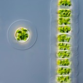 Hyalotheca dissilens green alga,LM