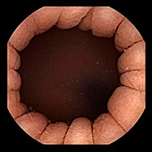 Peristalsis in the stomach