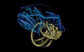 Hairy anglerfish,micro-CT scan