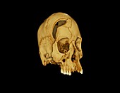 Nubian skull,micro-CT scan