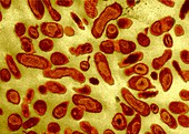 Coxiella burnetti bacteria,TEM